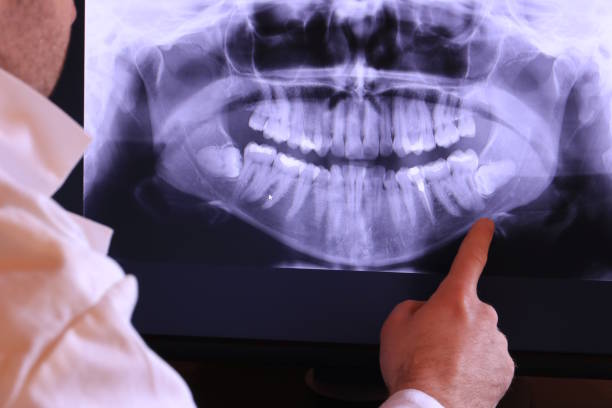 Best Emergency Treatment for Toothache in Vidalia, GA