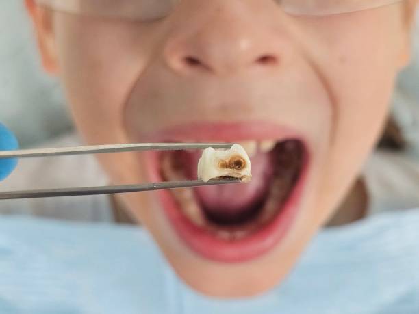 Best Emergency Dental Care for Trauma or Injury in Vidalia, GA