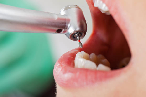 Best Walk-In Emergency Dentist in Vidalia, GA